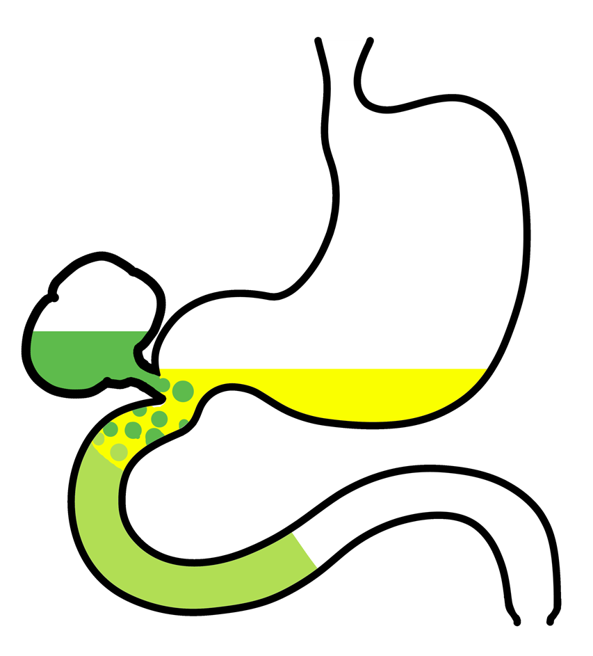 Two Stage FaSSIF